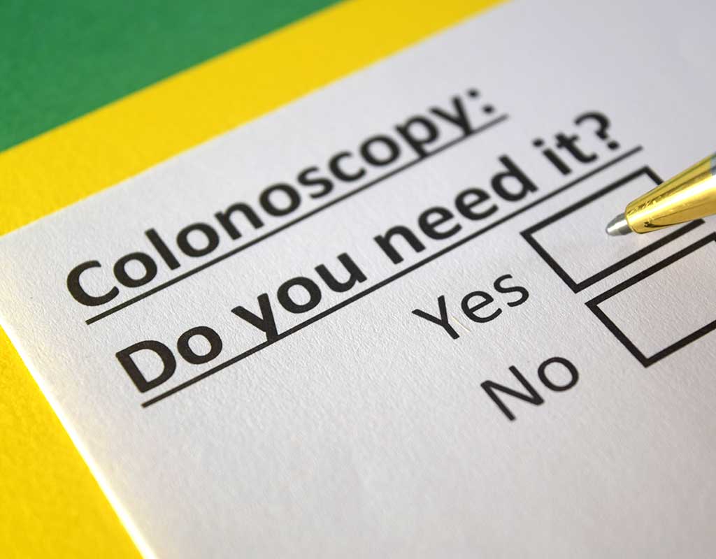 Screening for Colon Cancer - Who should get screened